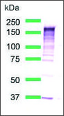 Anti-EGFR antibody, Rabbit monoclonal clone SP125, recombinant, expressed in proprietary host, affinity isolated antibody