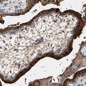 Anti-HSD17B1 antibody produced in rabbit Prestige Antibodies&#174; Powered by Atlas Antibodies, affinity isolated antibody, buffered aqueous glycerol solution