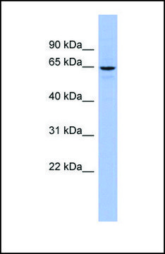 Anti-SLC34A3 antibody produced in rabbit affinity isolated antibody