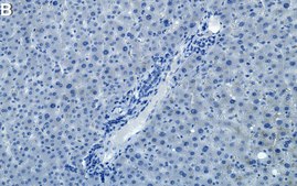 Anti-&#945; Actinin Antibody, clone AT6/172 ZooMAb&#174; Mouse Monoclonal recombinant, expressed in HEK 293 cells