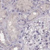 Anti-BFSP2 antibody produced in rabbit Prestige Antibodies&#174; Powered by Atlas Antibodies, affinity isolated antibody