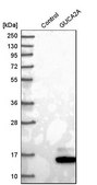 Anti-GUCA2A antibody produced in rabbit Prestige Antibodies&#174; Powered by Atlas Antibodies, affinity isolated antibody, buffered aqueous glycerol solution