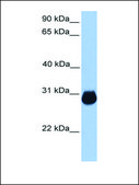 抗-IGFBP7 兔抗 affinity isolated antibody