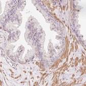 Anti-SLC29A3 antibody produced in rabbit Prestige Antibodies&#174; Powered by Atlas Antibodies, affinity isolated antibody, buffered aqueous glycerol solution