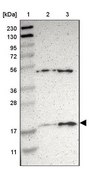 Anti-APOO antibody produced in rabbit Prestige Antibodies&#174; Powered by Atlas Antibodies, affinity isolated antibody, buffered aqueous glycerol solution