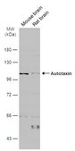 Anti-ENPP2 antibody produced in rabbit affinity isolated antibody, buffered aqueous solution