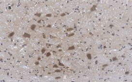 Anti-Choline Acetyltransferase (ChAT) Antibody, clone 2K16, ZooMAb&#174; Rabbit Monoclonal recombinant, expressed in HEK 293 cells