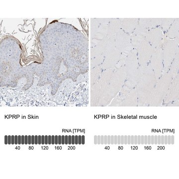 Anti-KPRP antibody produced in rabbit Prestige Antibodies&#174; Powered by Atlas Antibodies, affinity isolated antibody, buffered aqueous glycerol solution