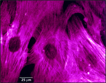 Monoclonal Anti-Actin, &#945;-Smooth Muscle clone 1A4, ascites fluid