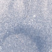 Monoclonal Anti-TBX19 antibody produced in mouse Prestige Antibodies&#174; Powered by Atlas Antibodies, clone CL6251, purified immunoglobulin, buffered aqueous glycerol solution