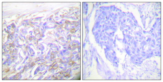 Anti-TNF Receptor I antibody produced in rabbit affinity isolated antibody