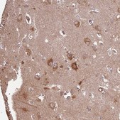 Anti-ACVR2A antibody produced in rabbit Prestige Antibodies&#174; Powered by Atlas Antibodies, affinity isolated antibody, buffered aqueous glycerol solution