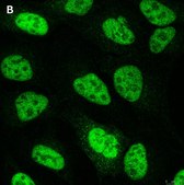 Anti-NCOA1 Antibody, clone 5B9, ZooMAb&#174; Rabbit Monoclonal recombinant, expressed in HEK 293 cells