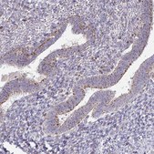 Anti-VPS4B antibody produced in rabbit Prestige Antibodies&#174; Powered by Atlas Antibodies, affinity isolated antibody, buffered aqueous glycerol solution