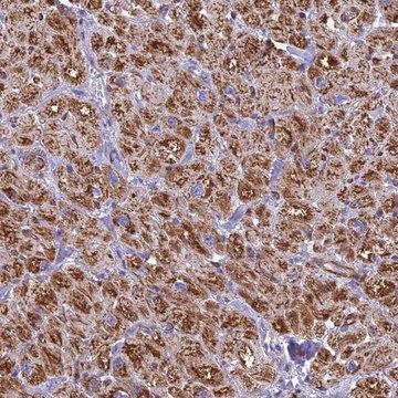 Anti-POMGNT1 antibody produced in rabbit Prestige Antibodies&#174; Powered by Atlas Antibodies, affinity isolated antibody, buffered aqueous glycerol solution