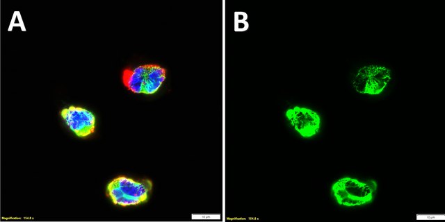 Anti-CD1a Antibody, clone 3J8 ZooMAb&#174; Rabbit Monoclonal recombinant, expressed in HEK 293 cells