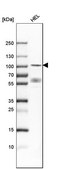 Anti-DYRK1A antibody produced in rabbit Prestige Antibodies&#174; Powered by Atlas Antibodies, affinity isolated antibody, buffered aqueous glycerol solution