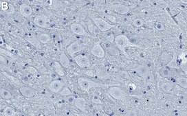 Anti-Opioid Receptor &#956; Antibody, clone 1E5 ZooMAb&#174; Rabbit Monoclonal recombinant, expressed in HEK 293 cells