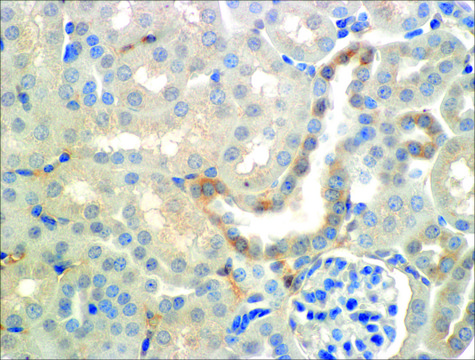 Monoclonal Anti-ENaC beta-Atto 594 antibody produced in mouse clone 7B8