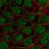 Anti-FOXN3 antibody produced in rabbit Prestige Antibodies&#174; Powered by Atlas Antibodies, affinity isolated antibody, buffered aqueous glycerol solution