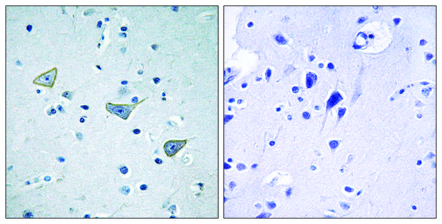 Anti-GPR158 antibody produced in rabbit affinity isolated antibody