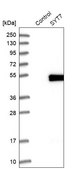Anti-SYT7 antibody produced in rabbit Prestige Antibodies&#174; Powered by Atlas Antibodies, affinity isolated antibody, buffered aqueous glycerol solution