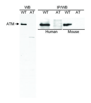 Goat anti-ATM Antibody, Affinity Purified Powered by Bethyl Laboratories, Inc.