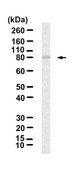 Anti-&#945;-Actinin 4 Antibody, clone 1D9 ZooMAb&#174; Rabbit Monoclonal recombinant, expressed in HEK 293 cells
