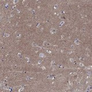 Anti-CPNE6 antibody produced in rabbit Prestige Antibodies&#174; Powered by Atlas Antibodies, affinity isolated antibody, buffered aqueous glycerol solution