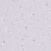 Anti-HRG antibody produced in rabbit Prestige Antibodies&#174; Powered by Atlas Antibodies, affinity isolated antibody, buffered aqueous glycerol solution