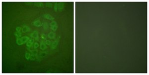 Anti-GR antibody produced in rabbit affinity isolated antibody