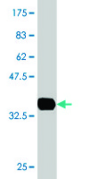 Monoclonal Anti-EPM2AIP1, (C-terminal) antibody produced in mouse clone 5G7, purified immunoglobulin, buffered aqueous solution