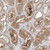 Anti-INPP4B antibody produced in rabbit Prestige Antibodies&#174; Powered by Atlas Antibodies, affinity isolated antibody, buffered aqueous glycerol solution
