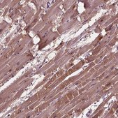Anti-ADPRHL1 antibody produced in rabbit Prestige Antibodies&#174; Powered by Atlas Antibodies, affinity isolated antibody, buffered aqueous glycerol solution