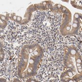 Anti-PDE5A antibody produced in rabbit Ab1, Prestige Antibodies&#174; Powered by Atlas Antibodies, affinity isolated antibody, buffered aqueous glycerol solution