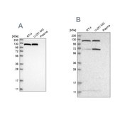 Anti-ACLY antibody produced in rabbit Prestige Antibodies&#174; Powered by Atlas Antibodies, affinity isolated antibody, buffered aqueous glycerol solution, Ab1
