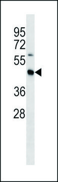 ANTI-MOUSE STRADB (C-TERM) antibody produced in rabbit IgG fraction of antiserum, buffered aqueous solution