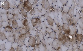 Anti-LEAP2 Antibody, clone 1D17 ZooMAb&#174; Rabbit Monoclonal recombinant, expressed in HEK 293 cells