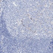 Anti-MAGI1 antibody produced in rabbit Prestige Antibodies&#174; Powered by Atlas Antibodies, affinity isolated antibody, buffered aqueous glycerol solution, ab2