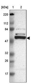 Anti-CASP8 antibody produced in rabbit Prestige Antibodies&#174; Powered by Atlas Antibodies, affinity isolated antibody, buffered aqueous glycerol solution