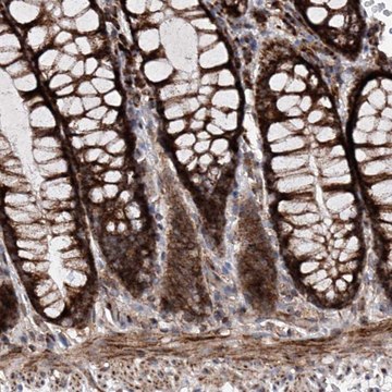 Anti-DAD1 antibody produced in rabbit Prestige Antibodies&#174; Powered by Atlas Antibodies, affinity isolated antibody, buffered aqueous glycerol solution