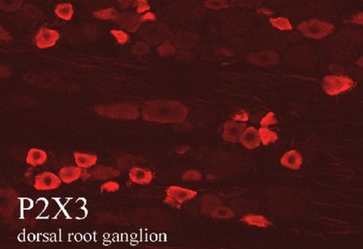 Anti-P2X3 Receptor Antibody, pain serum, Chemicon&#174;