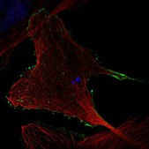 Anti-RHOBTB2 antibody produced in rabbit Prestige Antibodies&#174; Powered by Atlas Antibodies, affinity isolated antibody, buffered aqueous glycerol solution