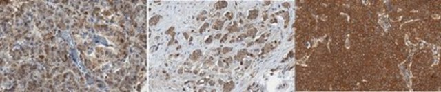 Anti-PDCD6-interacting protein Antibody, clone 12H1.2 clone 12H2.1, from mouse
