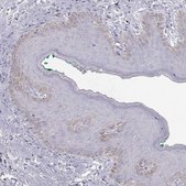 Anti-KRT31 antibody produced in rabbit Prestige Antibodies&#174; Powered by Atlas Antibodies, affinity isolated antibody, buffered aqueous glycerol solution