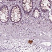 Anti-GAL antibody produced in rabbit Prestige Antibodies&#174; Powered by Atlas Antibodies, affinity isolated antibody, buffered aqueous glycerol solution