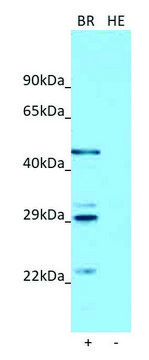 Anti-ASGR1 antibody produced in rabbit affinity isolated antibody