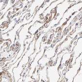 Anti-ITGA8 antibody produced in rabbit Prestige Antibodies&#174; Powered by Atlas Antibodies, affinity isolated antibody, buffered aqueous glycerol solution