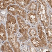 Anti-CFI antibody produced in rabbit Prestige Antibodies&#174; Powered by Atlas Antibodies, affinity isolated antibody, buffered aqueous glycerol solution