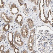 Anti-LRBA antibody produced in rabbit Prestige Antibodies&#174; Powered by Atlas Antibodies, affinity isolated antibody, buffered aqueous glycerol solution, Ab1
